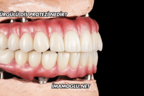 Sürgülü Diş Protezi Nedir?